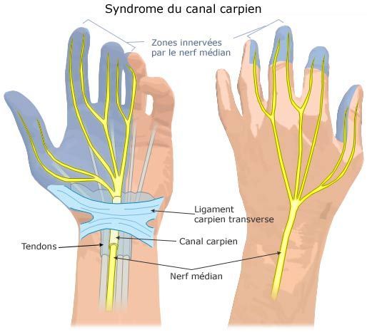 Le_syndrome_du_canal_carpien