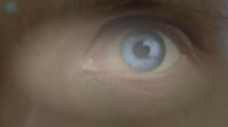oneye2