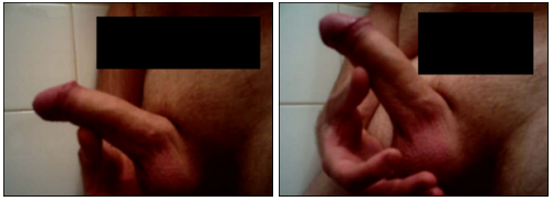 MARCO_1