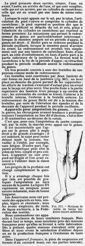 prothèses de membres8
