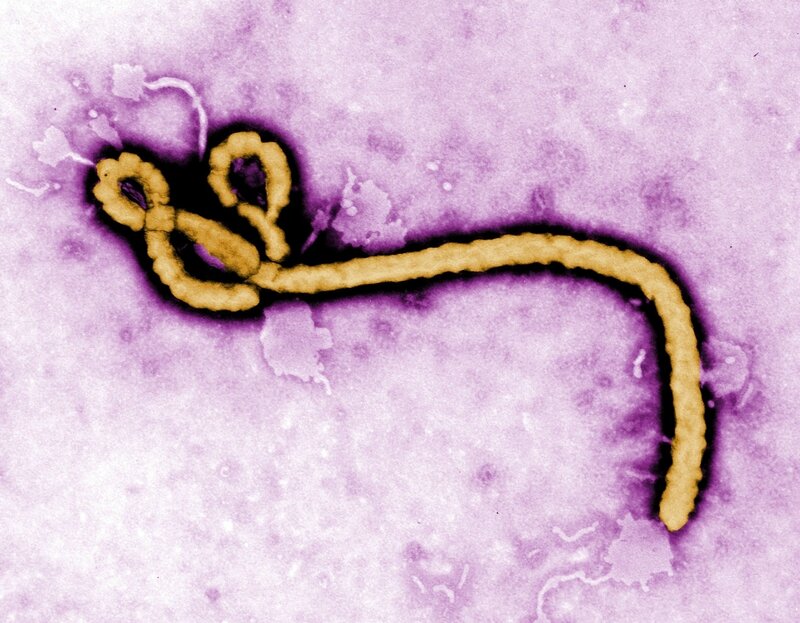 virus ébola13
