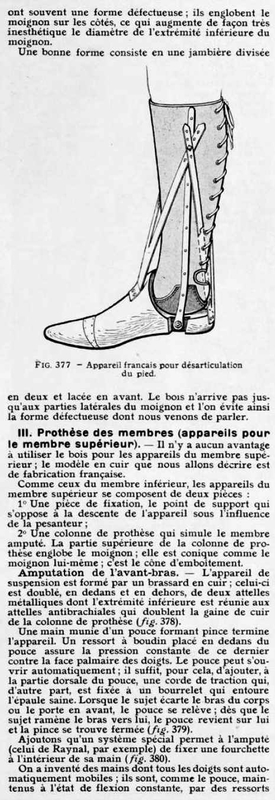 prothèses de membres12