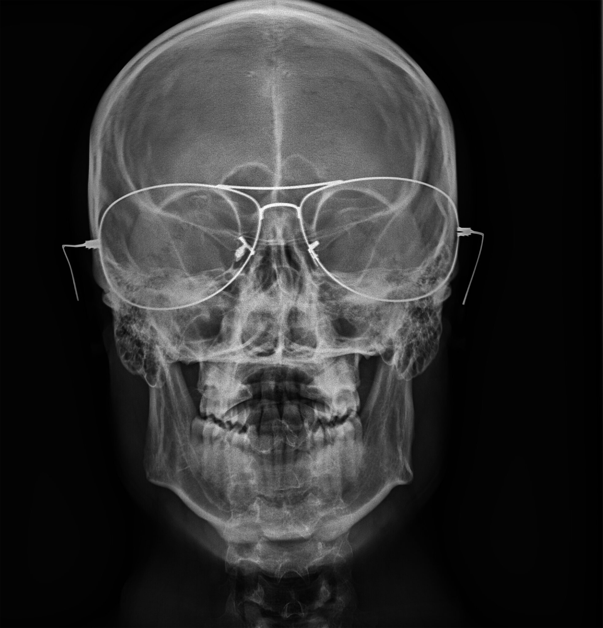 Sébastien Laurentselfportrait30x30cm