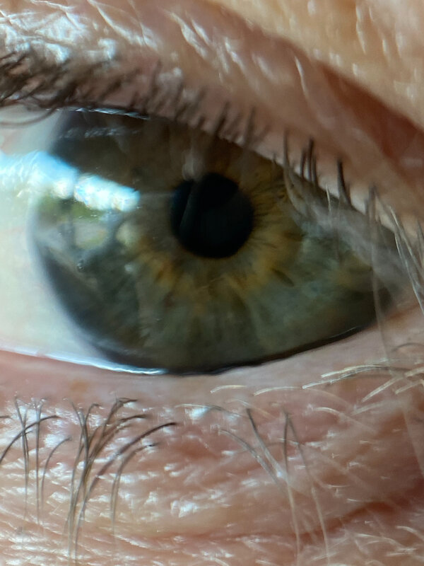 son oeil