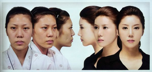 korean plastic surgery 4