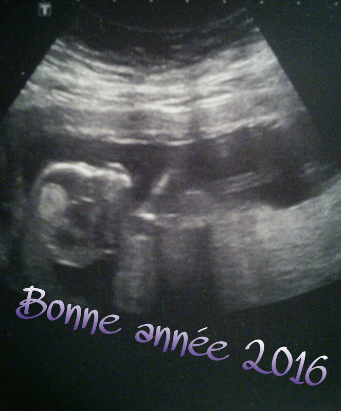 PicsArt_12-29-08