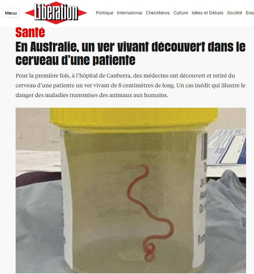 alien dans le cerveau