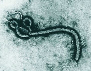ebola