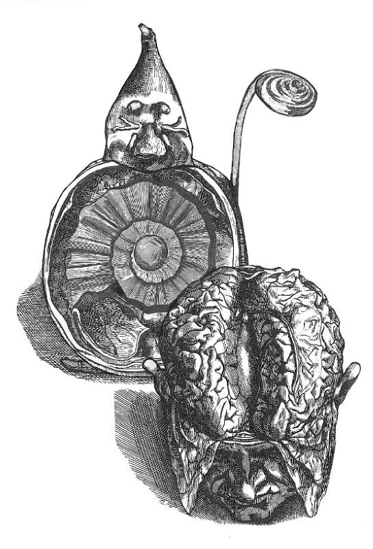 Décervelage