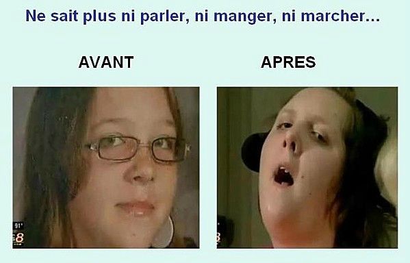 Victime-Gardasil-1b