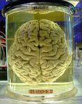 cerveau_humain