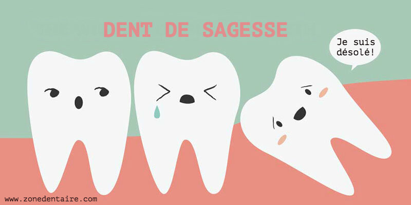 dent-de-sagesse