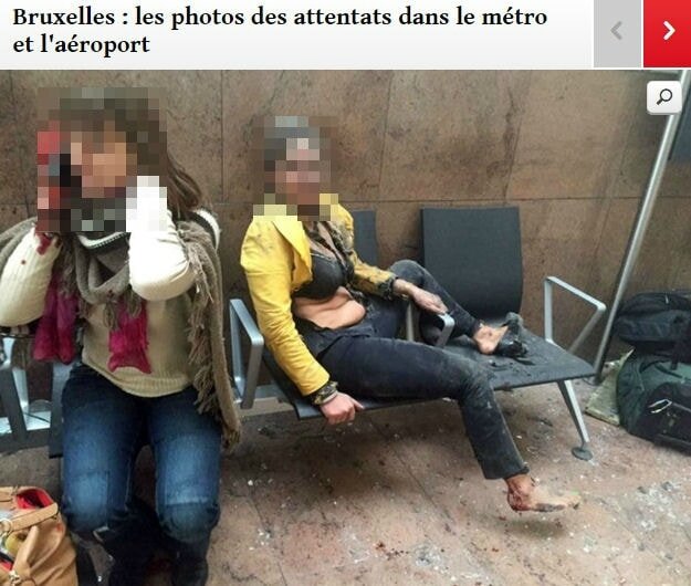 Photo-attentats-Bruxelles-blessés