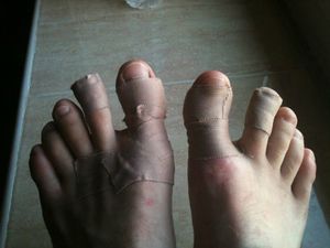pieds pep