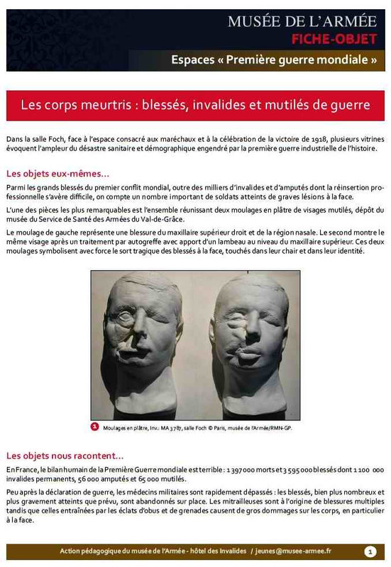 Gueules cassées1