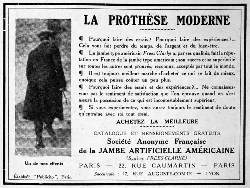 La prothèse moderne