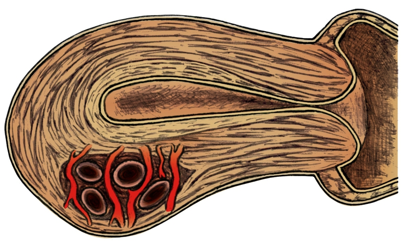 figure 5 uterus retouchee