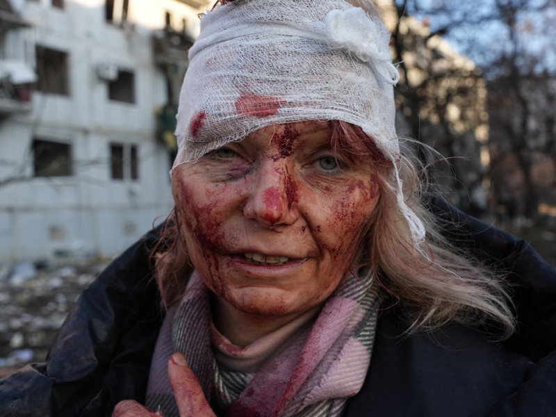 Olena Kurilo was the first injured person Schwan saw after a missile strike in Chuhuiv