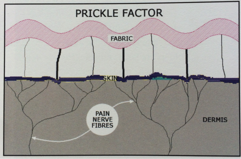 prickle factor