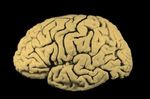 cerveau