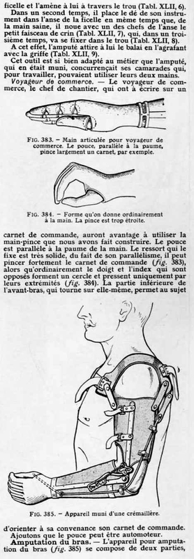 prothèses de membres16