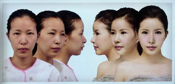 korean plastic surgery 3