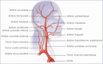 accidentvasculairecerebral3