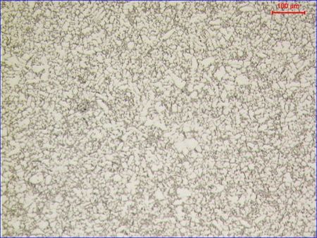 Microstructure_AlSi9Cu3_2