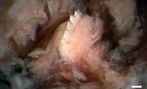 RTEmagicC_Dents_Tyrannobdella_rex_Anna_J_Phillips_et_al