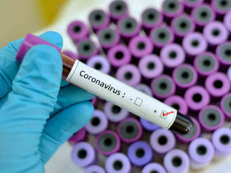 lagos-state-gov-alert-against-coronavirus