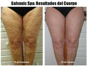 Galvanic-Spa-and-Body-Shaping-Gel-removing-cellulite-in-2-months