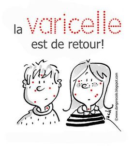 varicelle