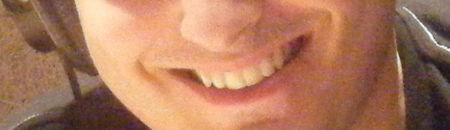 ALBANITO_SMILE