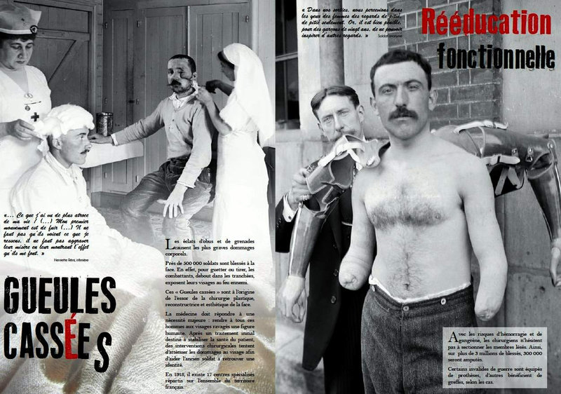 chirurgie de guerre17
