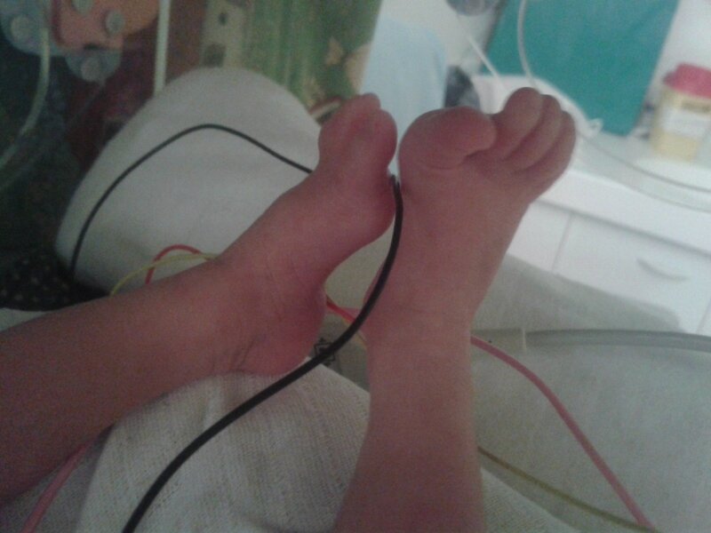 pieds de bébé J7