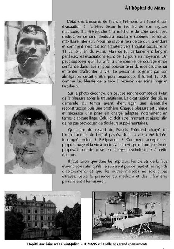 Gueules cassées8