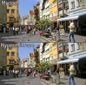 myope_hypermetrope