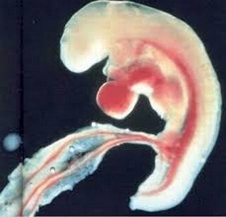 grossesse-embryon 3sem