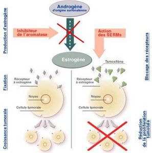 cancer-sein-hormonotherapie