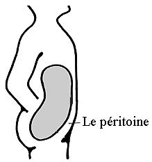 le_peritoine