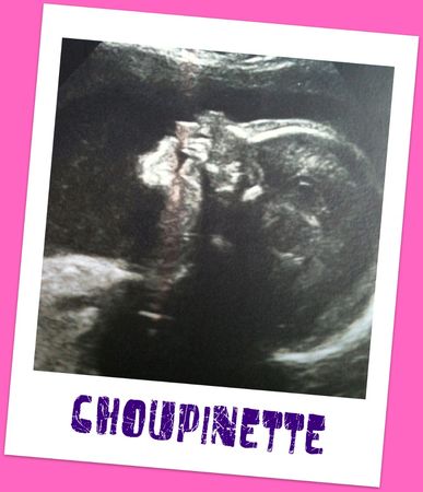 choupinette