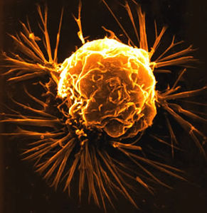 cancer_cellule