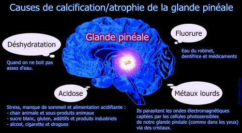 calcification glande pineale