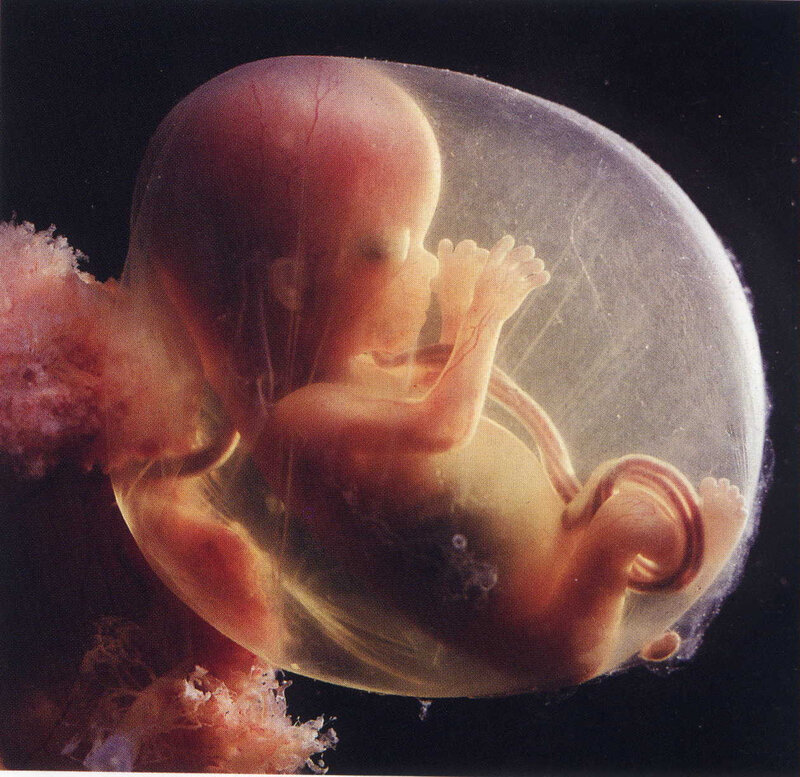 enfant-avortement-pro-vie