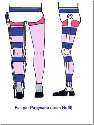 Orthèse de jambe par Papynano