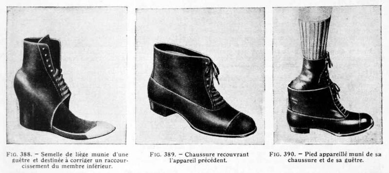 prothèses de membres18