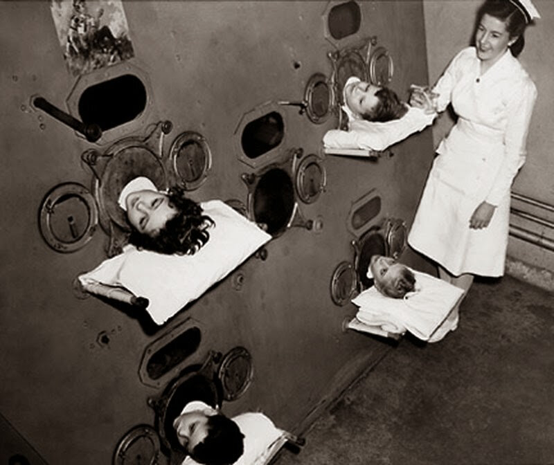 children in an iron lung before the advent of the polio vaccination