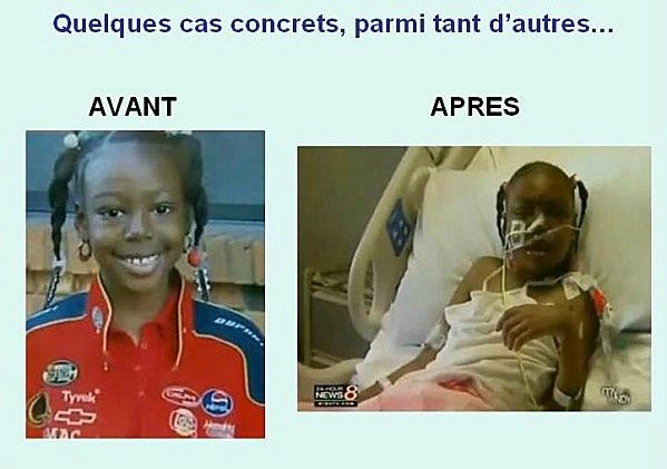 Victime-Gardasil-1a
