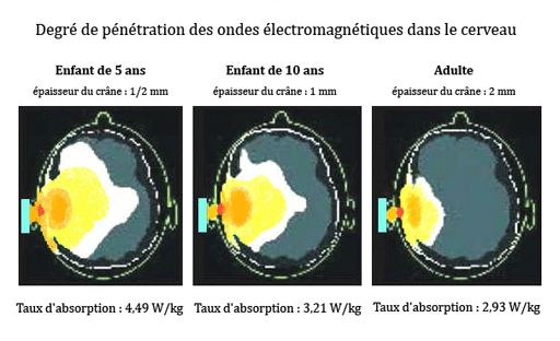 absorption onde cerveau