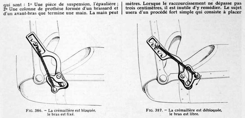 prothèses de membres17